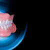 OHI-S Minimal inversiv – not only veneers & Complete dentures as a basis for all on four