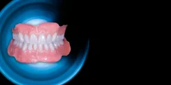 OHI-S Minimal inversiv – not only veneers & Complete dentures as a basis for all on four
