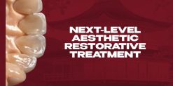 OHI-S Next-Level Aesthetic Restorative Treatment. Protocols from the Legends of Japanese Dental Schools