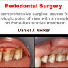Periodontal Surgery: A Comprehensive Surgical Course