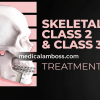 OHI-S Skeletal Class 2 & Class 3 treatment team approach orthodontist-surgeon