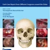 100 Complications of Otorhinolaryngology & Skull Base Surgery (Original PDF from Publisher+Videos)