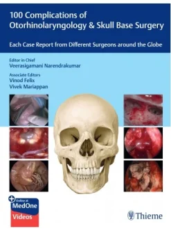 100 Complications of Otorhinolaryngology & Skull Base Surgery (Original PDF from Publisher+Videos)