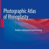 Photographic Atlas of Rhinoplasty book and videos