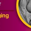 Knee Imaging Essentials 2023 WEBCAST SERIES