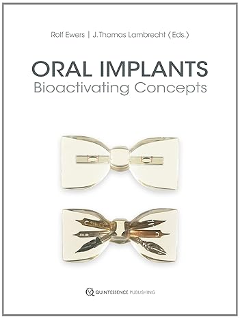 Oral Implants: Bioactivating Concepts (Scanned PDF) Oral Implants: Bioactivating Concepts (Scanned PDF)