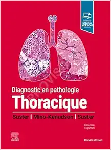 Diagnostic en pathologie thoracique (True PDF from Publisher)