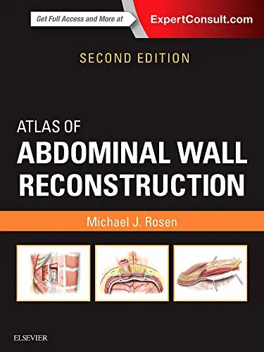 Atlas of Abdominal Wall Reconstruction, 2nd Edition (Videos, Organized) Atlas of Abdominal Wall Reconstruction, 2nd Edition (Videos, Organized)