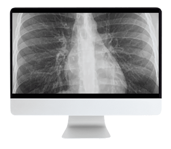 ARRS Liver, Pancreatic, and Biliary Tumors 2022 (Videos + CME Questions) ARRS Liver, Pancreatic, and Biliary Tumors 2022 (Videos + CME Questions)