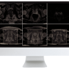 ARRS Pearls and Pitfalls in Prostate and Pelvic Imaging 2021