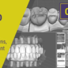 BASIC EXOCAD: Models, Crowns, Splints, Implant Crowns, AOX, & More