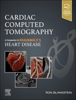 Cardiac Computed Tomography A Companion to Braunwald’s Heart Disease (EPUB)