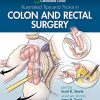 Cleveland Clinic Illustrated Tips and Tricks in Colon and Rectal Surgery (EPUB)