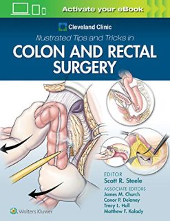Cleveland Clinic Illustrated Tips and Tricks in Colon and Rectal Surgery (EPUB)