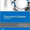Dupuytren’s Disease: A Scientific Review (True PDF from Publisher)