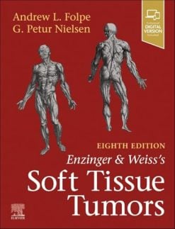 Enzinger and Weiss’s Soft Tissue Tumors, 8th edition (EPUB)