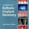 Fundamentals of Esthetic Implant Dentistry