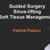 Guided Surgery, Sinus-Lifting, Soft Tissue Management