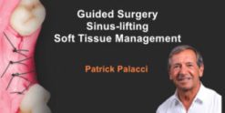 Guided Surgery, Sinus-Lifting, Soft Tissue Management