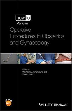How to Perform Operative Procedures in Obstetrics and Gynaecology (20 High Quality Procedures Video)
