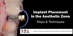 Soft Tissue Plastic Surgery Around Implants