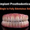 Implant Prosthodontics – From Single to Fully Edentulous Solutions