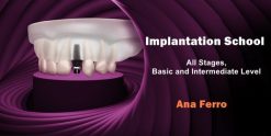 Implantation School: All Stages, Basic and Intermediate Level