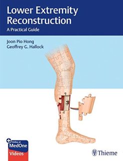 Lower Extremity Reconstruction: A Practical Guide (Original PDF from Publisher+Videos)