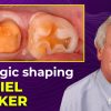 OHI-S Biologic Shaping a conservative alternative to crown lengthening 4 lessons 1h 54m