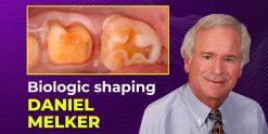 OHI-S Biologic Shaping a conservative alternative to crown lengthening 4 lessons 1h 54m