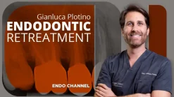 Osteocom Endodontic Retreatment