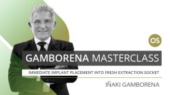 Osteocom Gamborena Masterclass Immediate implant placement into fresh extraction socket