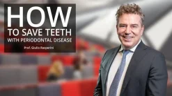 Osteocom How To Save Teeth With Periodontal Disease