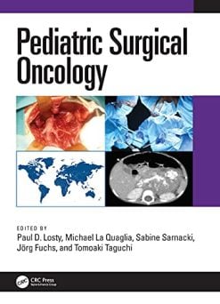 Pediatric Surgical Oncology (Original PDF from Publisher)