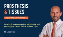 Prosthesis and Tissues (Prosthetic Management of Periodontal and Peri-Implant Tissues)