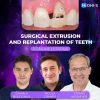 Surgical Extrusion and Replantation of Teeth