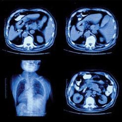 UCSF Abdominal and Thoracic Imaging 2022 ( VIDEOS)
