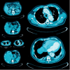 UCSF Abdominal and Thoracic Imaging 2025