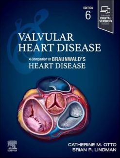 Valvular Heart Disease A Companion to Braunwald’s Heart Disease, 6th edition (EPUB)