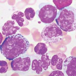 Hematopathology 2021