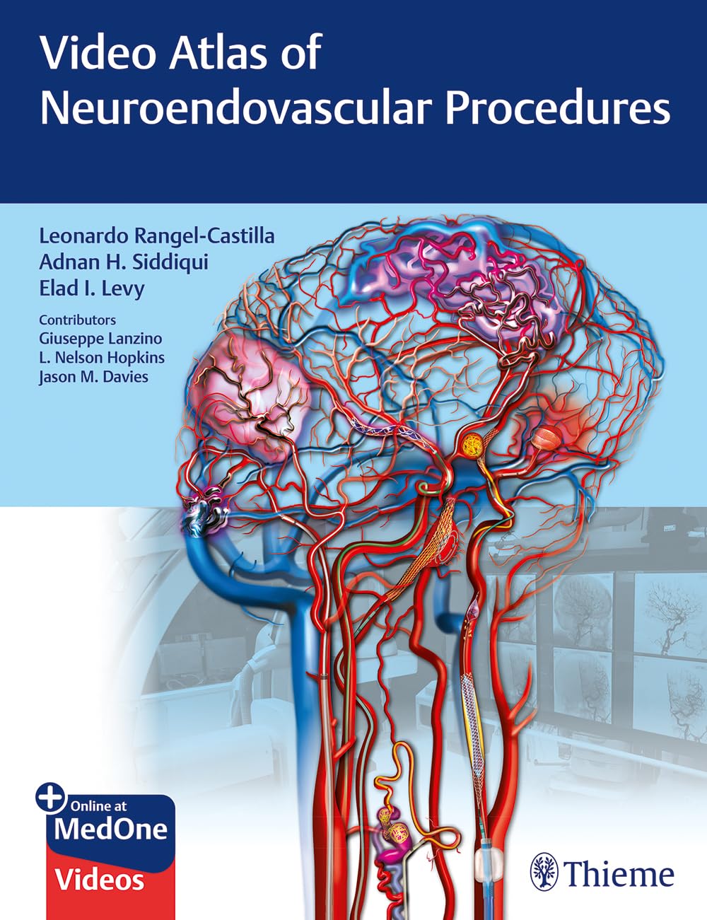 Video Atlas of Neuroendovascular Procedures 1st Edición Video Atlas of Neuroendovascular Procedures 1st Edición