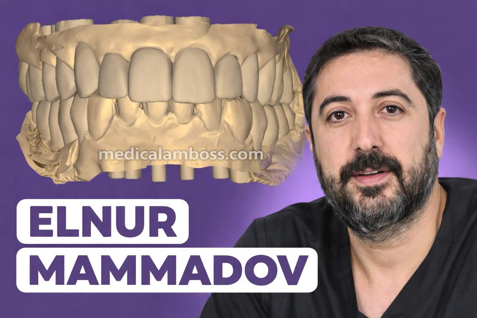 OHI-S La chaîne numérique dans la réhabilitation orale