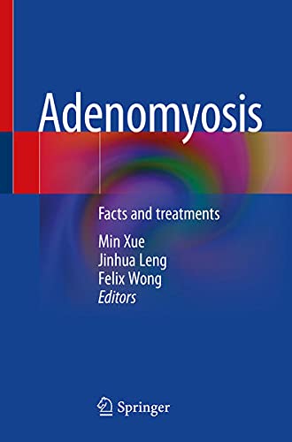 Adenomyosis: Facts and treatments (Original PDF from Publisher) Adenomyosis: Facts and treatments (Original PDF from Publisher)