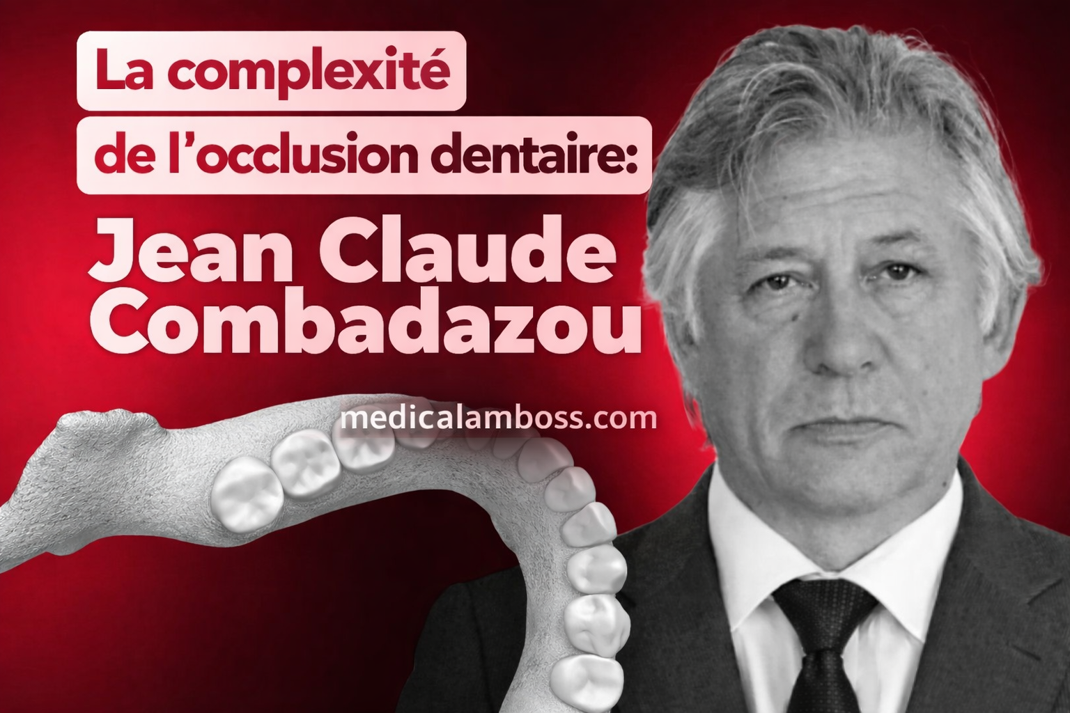 OHI-S La complexité de l’occlusion dentaire Diagnostic et traitement