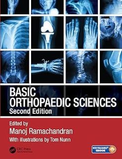 Basic Orthopaedic Sciences, The Stanmore Guide, 2nd Edition