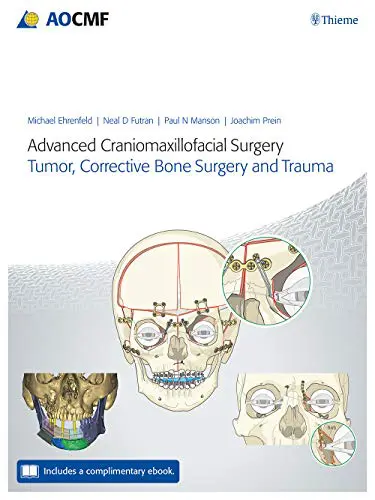 Advanced Craniomaxillofacial Surgery: Tumor, Corrective Bone Surgery, and Trauma (Original PDF from Publisher) Advanced Craniomaxillofacial Surgery: Tumor, Corrective Bone Surgery, and Trauma (Original PDF from Publisher)