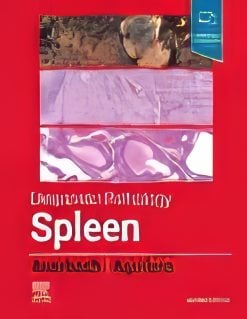 Diagnostic Pathology: Spleen, 2nd Edition (Original PDF from Publisher)