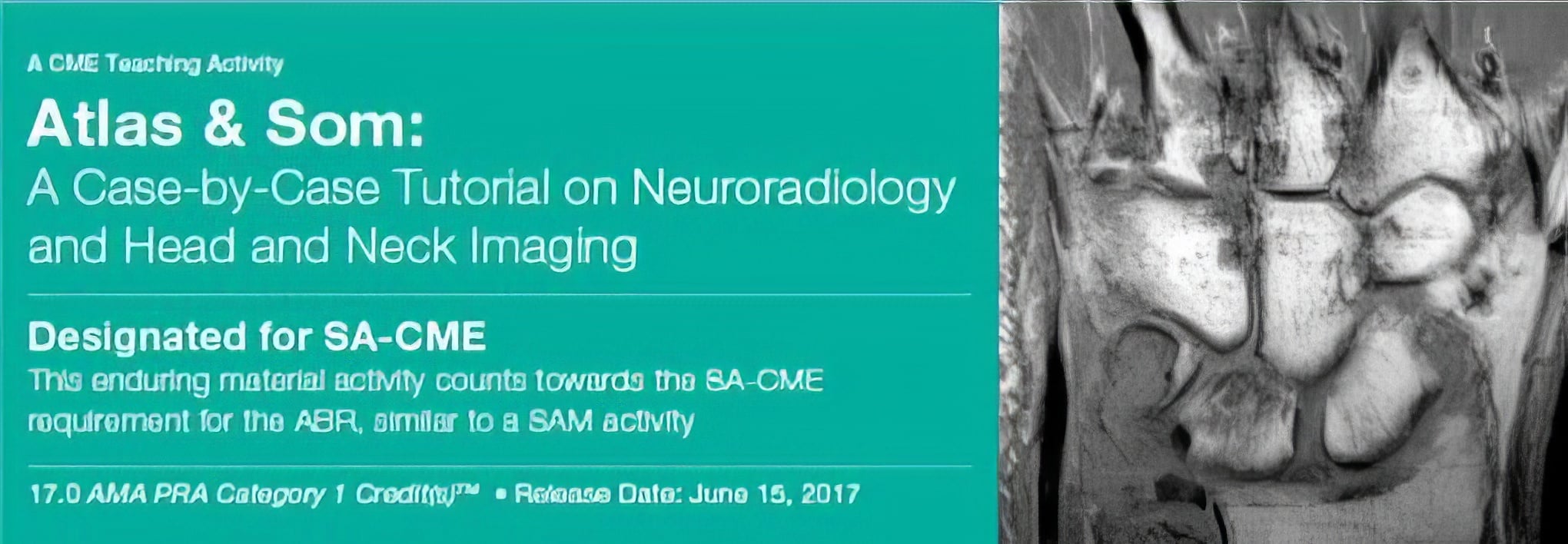 Atlas & Som: A Case-by-Case Tutorial On Neuroradiology and Head and Neck Imaging 2017 ( Videos)