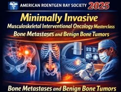 ARRS Minimally Invasive Musculoskeletal Interventional Oncology Masterclass 2025