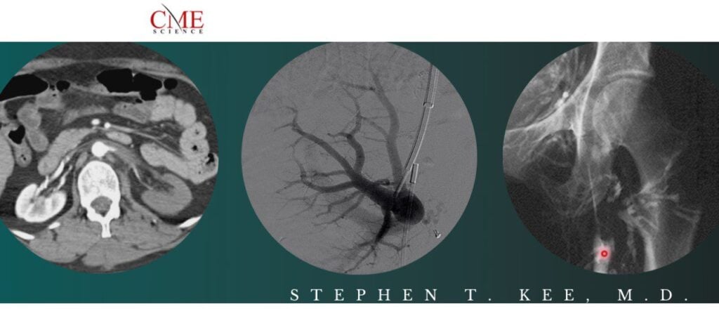 Science Interventional Radiology Stephen T. Kee, M.D 2021 (VIDEOS)